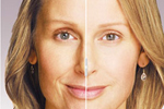 Botox, Juvederm, Restylane & Radiesse