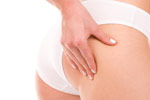 Cellulite and Stretch Mark Treatments